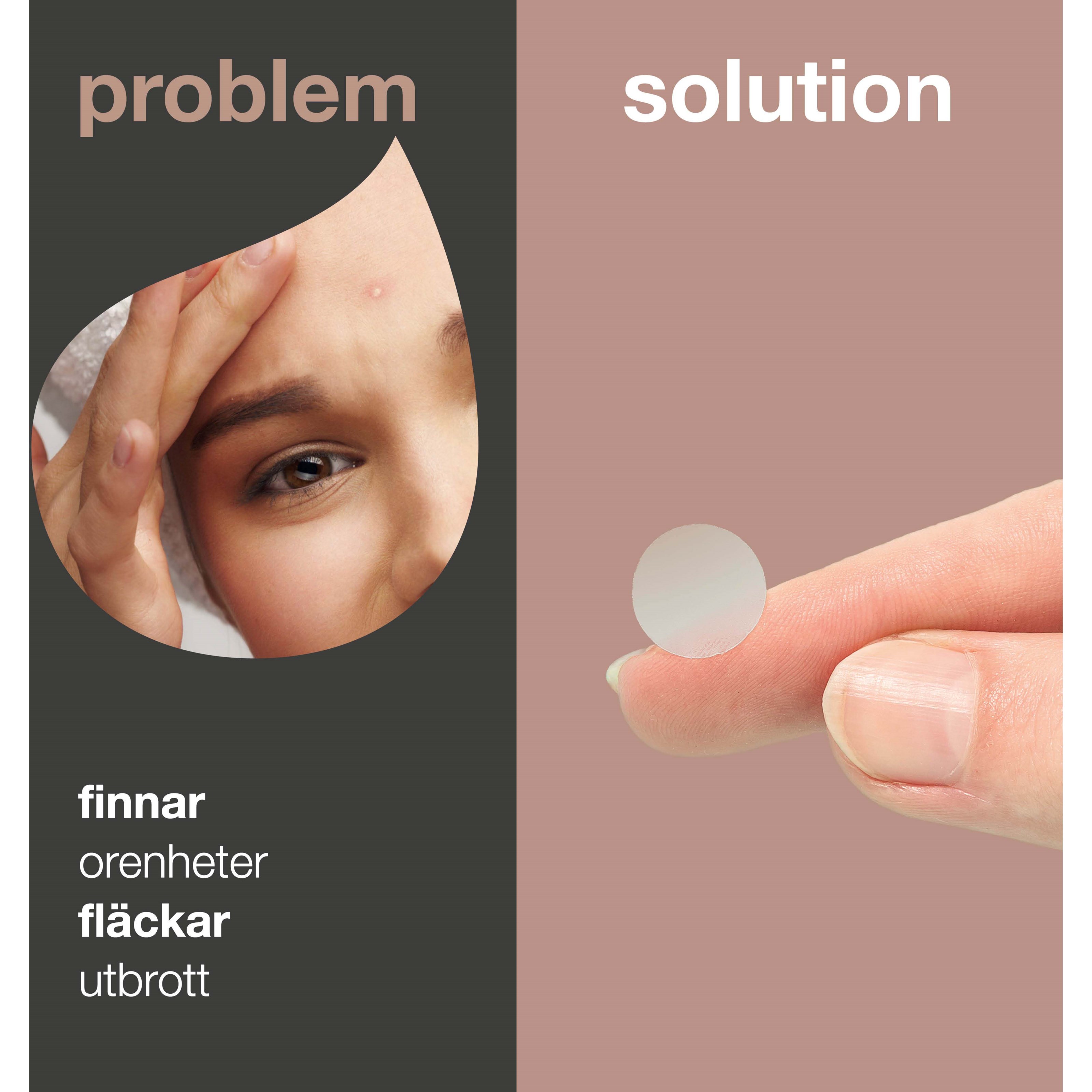 Alternativ bild 1 för Australian Bodycare Pimple Patches   20 stk.