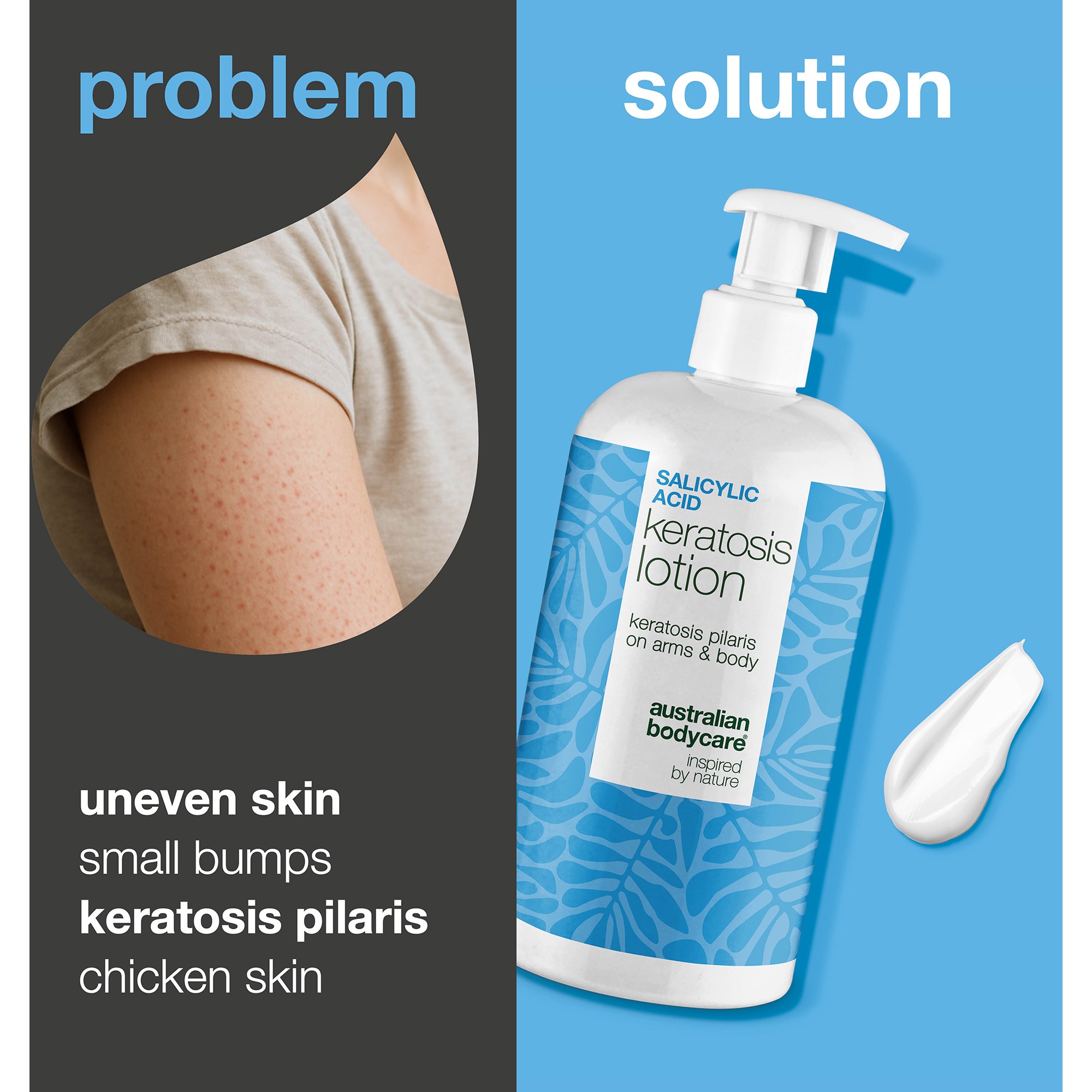 Australian Bodycare Salicylic Acid Keratosis Lotion 500 ml (obrázok 2)