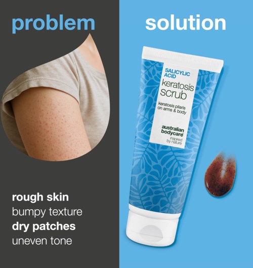 Problem with rough skin, dry patches, and uneven tone shown next to keratosis scrub tube.