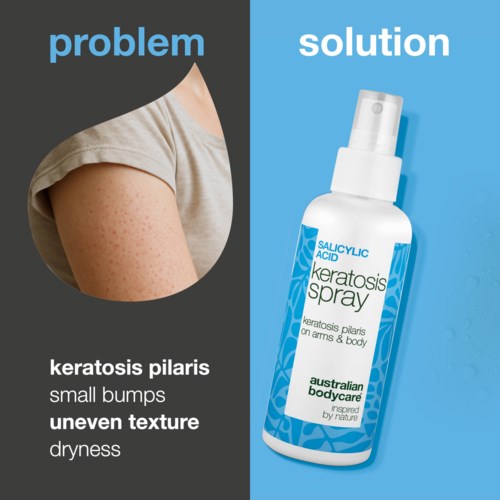 A split image shows skin bumps on one side and a spray bottle labeled for keratosis on the other.