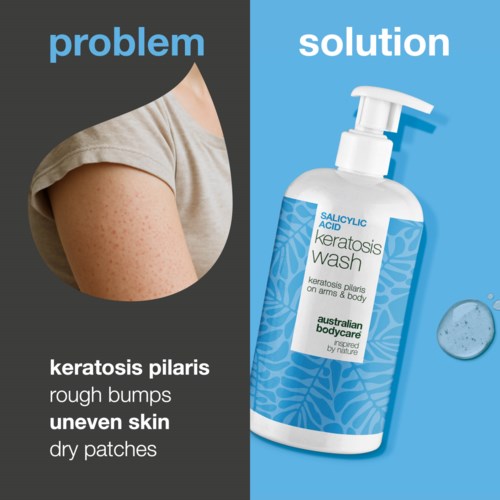 Diagram compares skin problems like bumps and patches with a solution called keratosis pilaris wash.