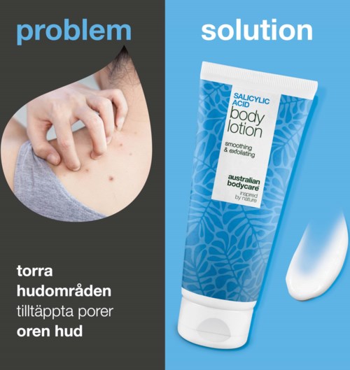 A visual comparison shows skin problem areas with pimples and a bottle of salicylic acid body lotion for treatment.