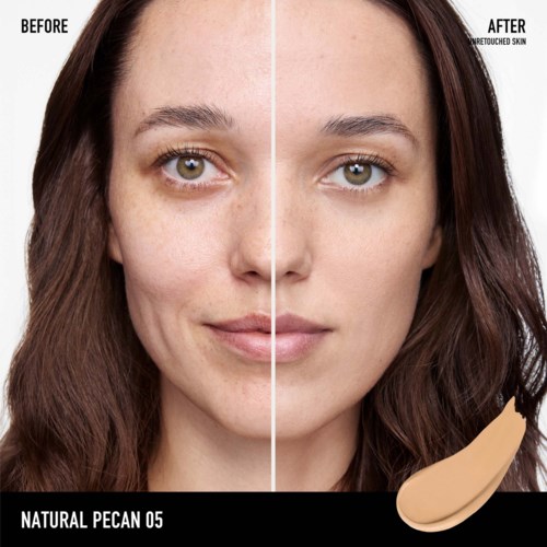 Side-by-side comparison of a woman's face shows clearer skin after treatment, with makeup applied on the right side.