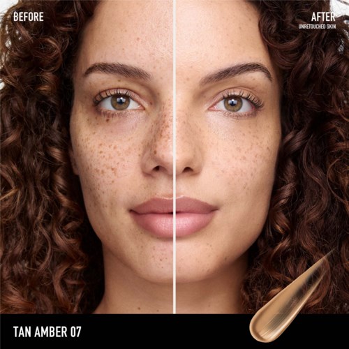 Before and after skin treatment images showing reduced freckles and clearer, smoother skin.
