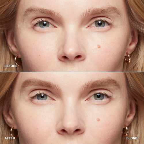 A woman with blonde hair and blue eyes, showing a noticeable change in skin tone and texture after a treatment.