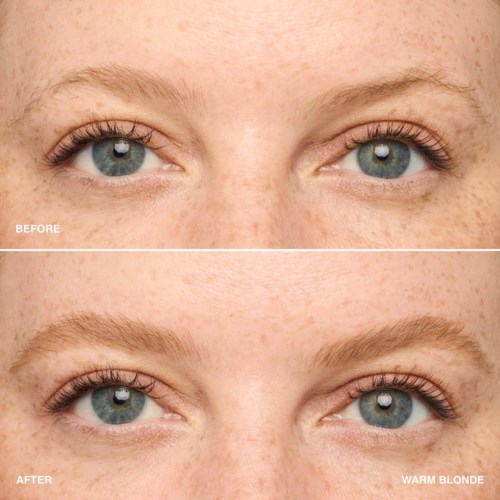 Nahaufnahme von Augen mit Vorher- und Nachher-Bilder, Fokus auf Hautfarbe und Textur. Kein Make-up.