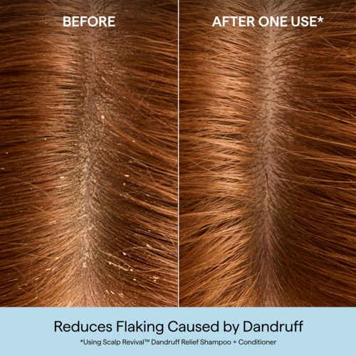Briogeo Scalp Revival™ Dandruff Relief Conditioner 248 ml