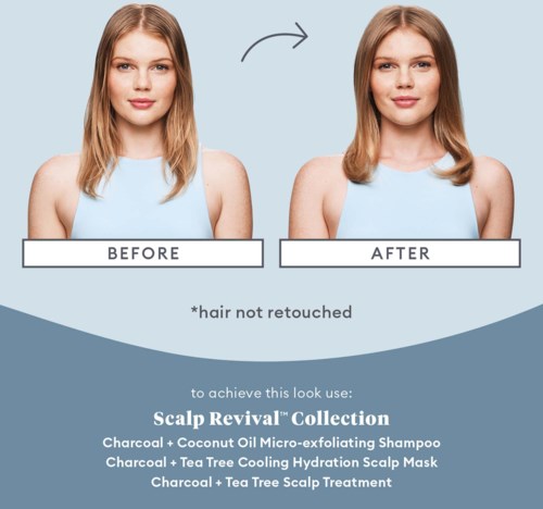 Briogeo Scalp Revival Scalp Soothing Solutions Set