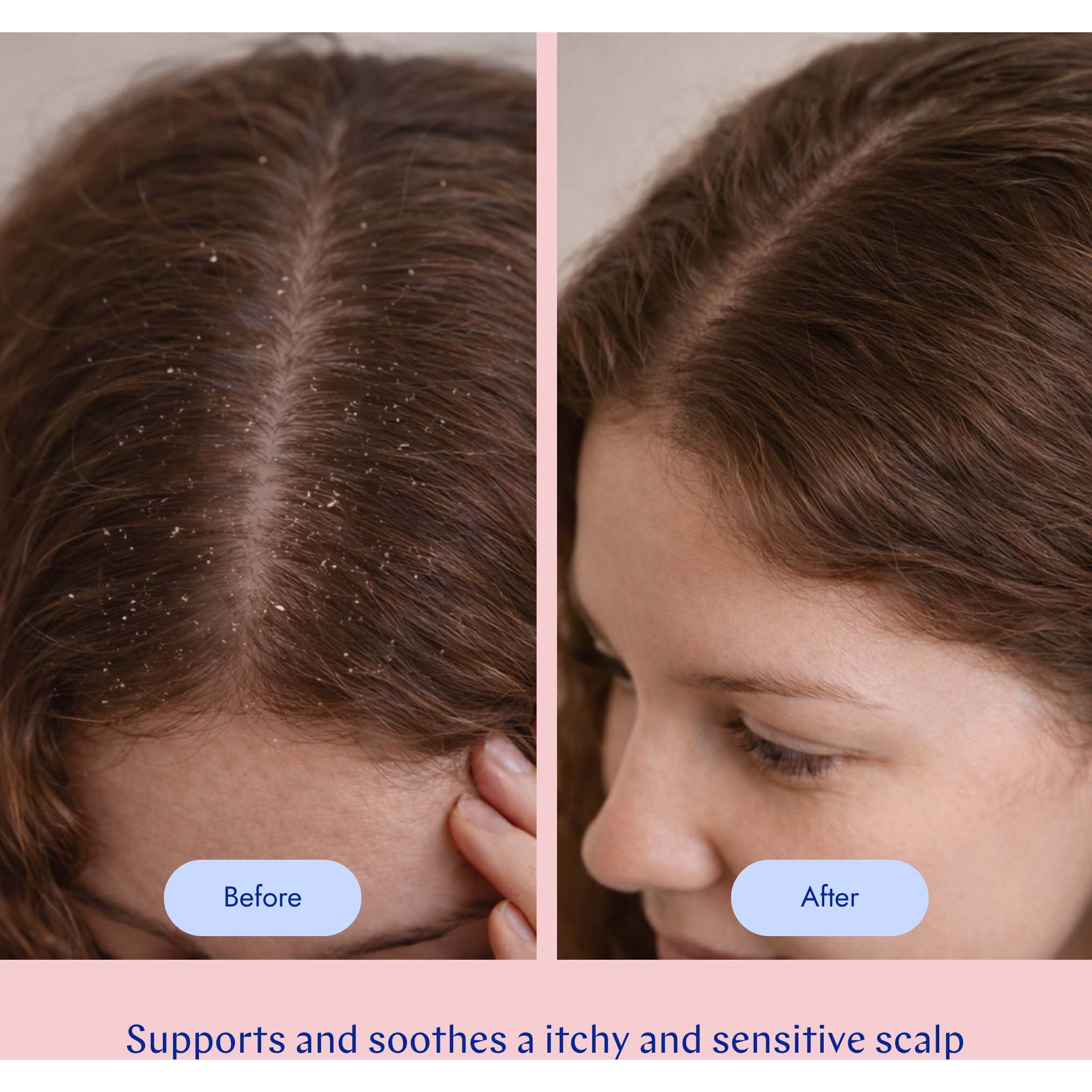 By Veira Scalp Care Masque 200 ml (zdjęcie 4)