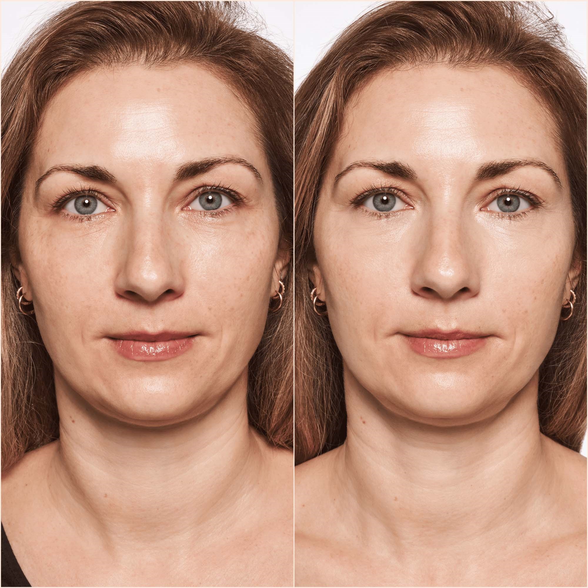 Catrice Korektor Liquid Camouflage High Coverage Concealer 10 (obrázok 5)