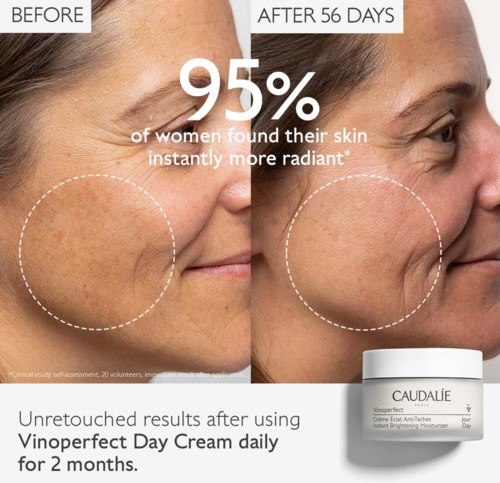 Side-by-side comparison shows skin improvement after 56 days using Vinoperfect Day Cream.