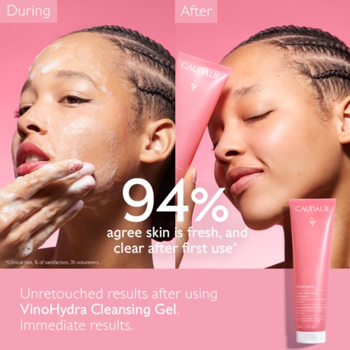 Before and after photos showing clear skin after using VinoHydra Cleansing Gel. 94% agree skin is fresh and clear.