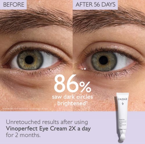 Før- og efterbilleder, der viser hudforbedringer omkring øjet efter 2 måneders brug af Vinoperfect Eye Cream.
