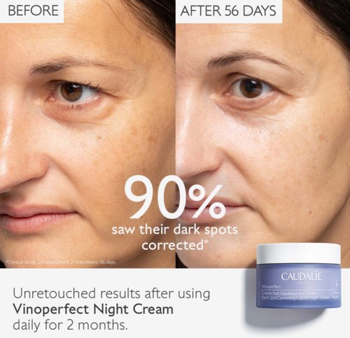 Sammenligning der mørke pletter er reduceret efter 56 dage med brug af Vinoperfect Night Cream.