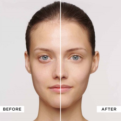 A woman’s face shows clear skin after skincare, with a split comparison for before and after treatment.