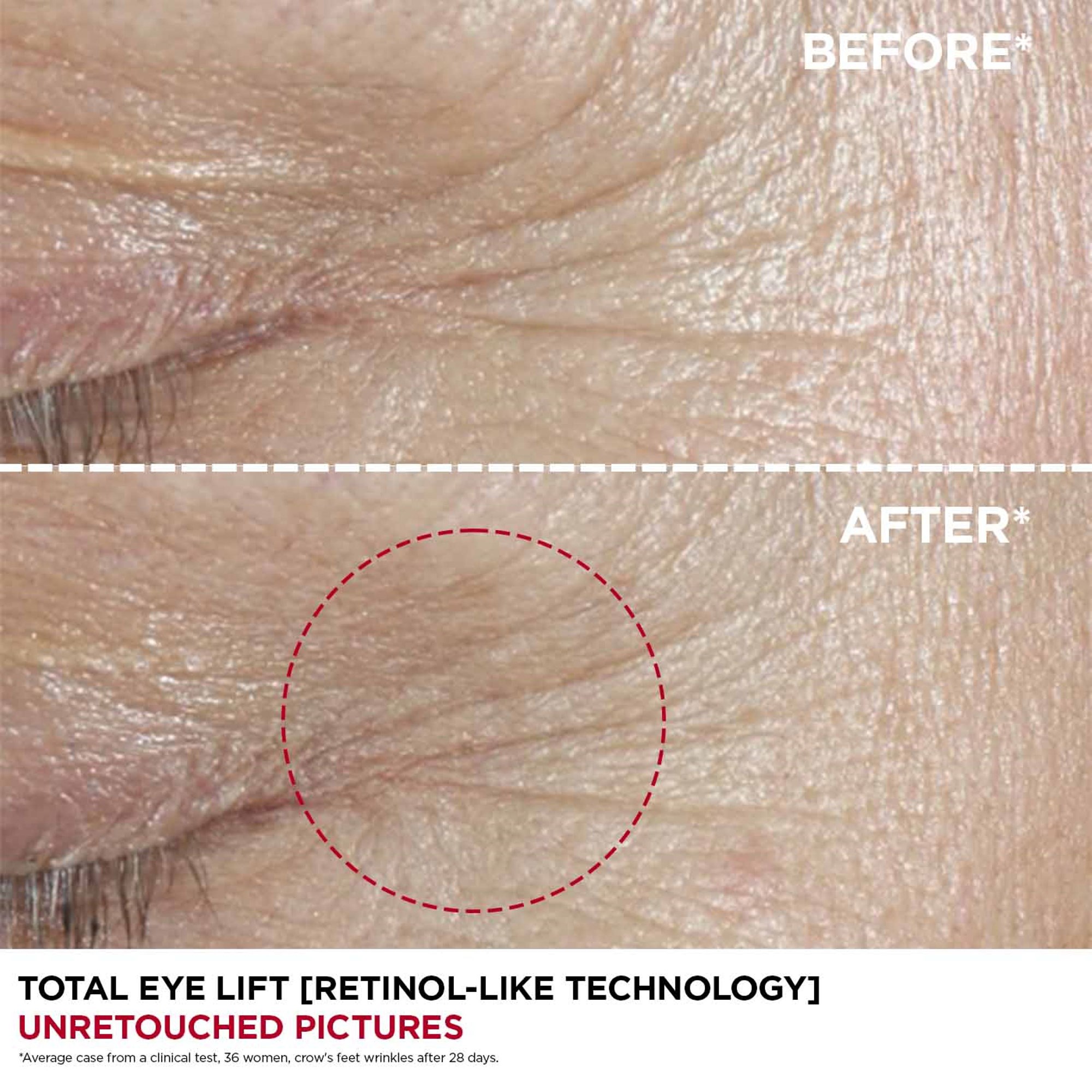 Clarins Total Eye Lift Eye Concentrate 15 ml (zdjęcie 8)