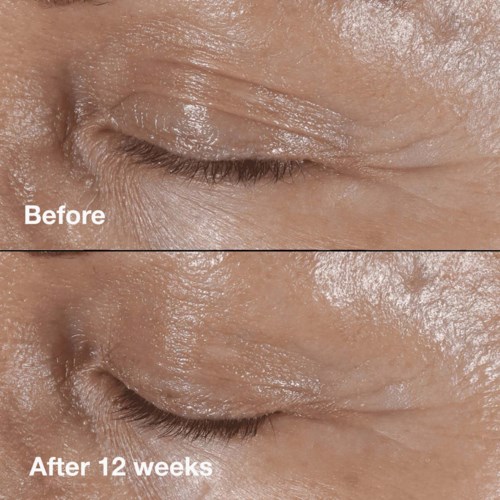 Clinique Smart Clinicial Repair Wrinkle Correcting Eye Cream 15 ml