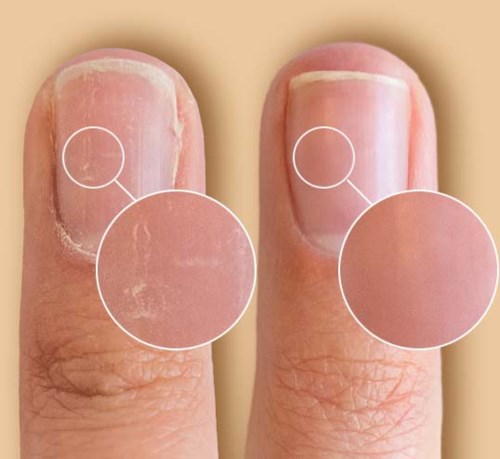 Comparison of dry and healthy fingernails, highlighting cleanliness and nail health.