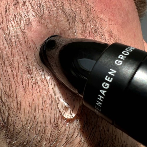 Ein Nahaufnahme eines Gesichts, bei dem eine Taschenlampe oder Mikroskop in die Nase leuchtet, zeigt Haut und Haare.