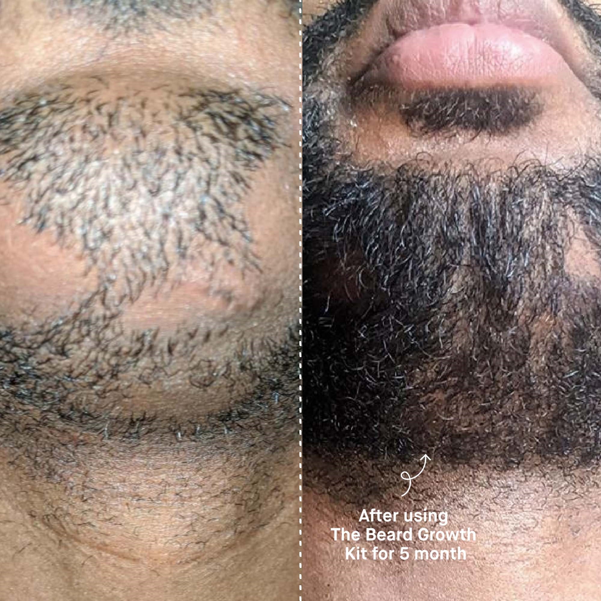 Copenhagen Grooming Beard The Beard Growth Kit (obrázok 10)