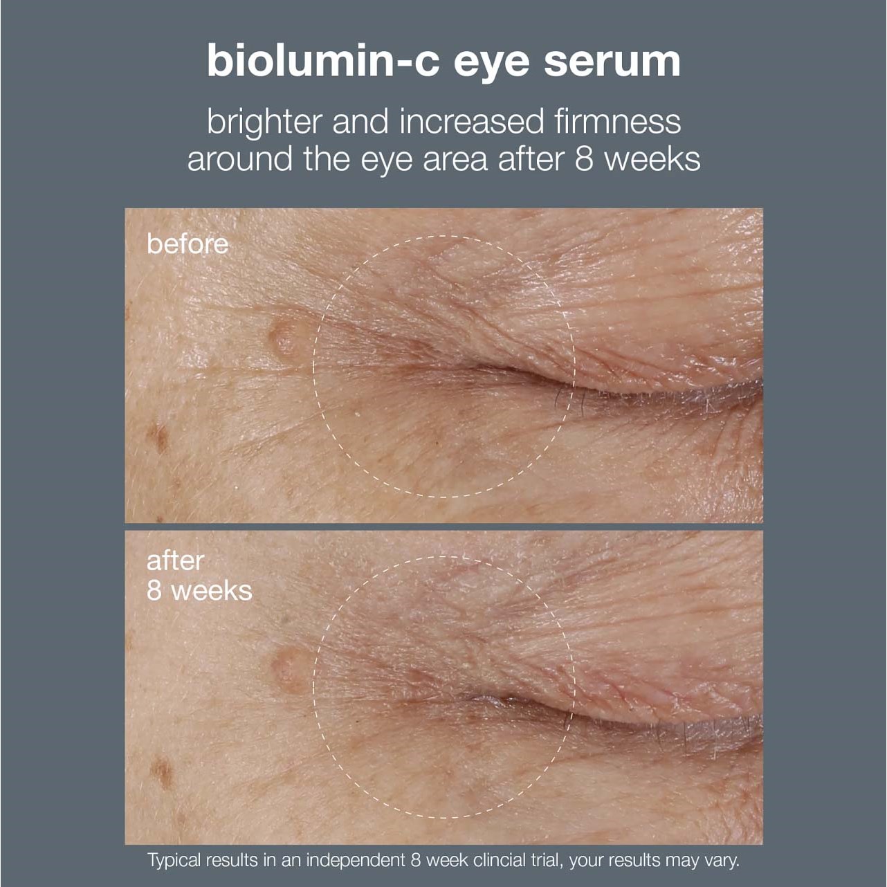 Dermalogica Biolumin-C Eye Serum 15 ml (obrázok 8)