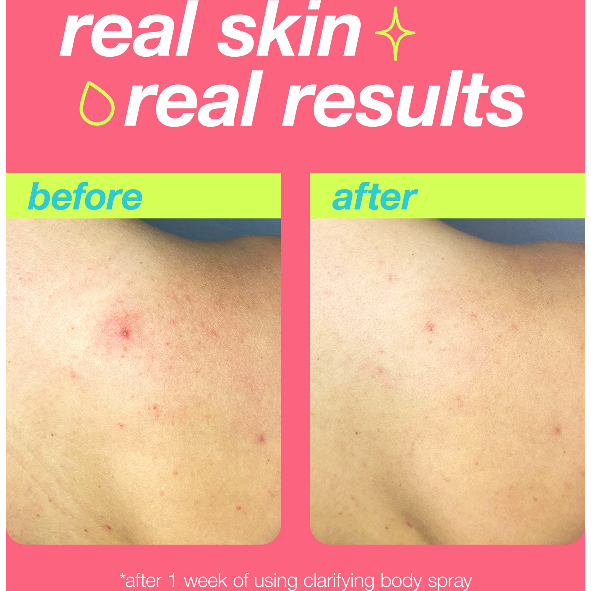 Dermalogica Clear Start Clarifying Body Spray 177 ml (obrázok 4)