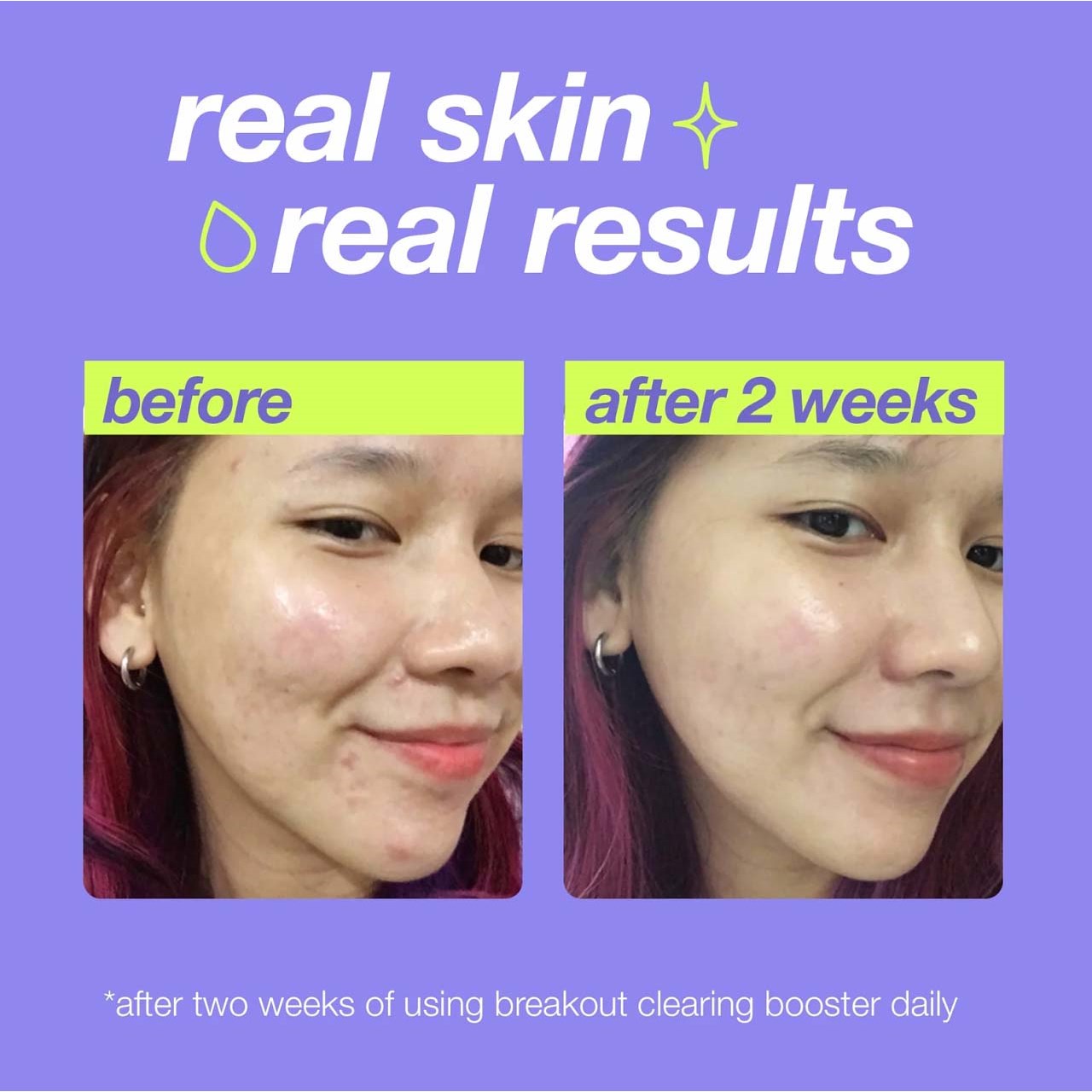 Dermalogica Clear Start Breakout Clearing Booster 30 ml (obrázok 10)
