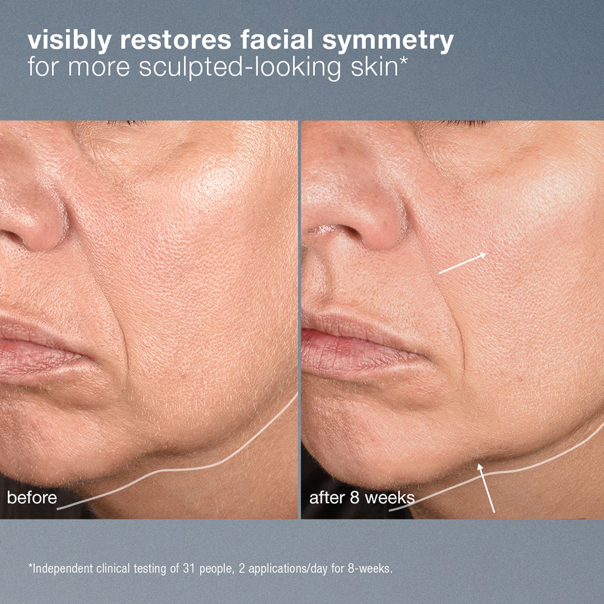 Dermalogica Neurotouch Symmetry Serum 30 ml (obrázok 8)