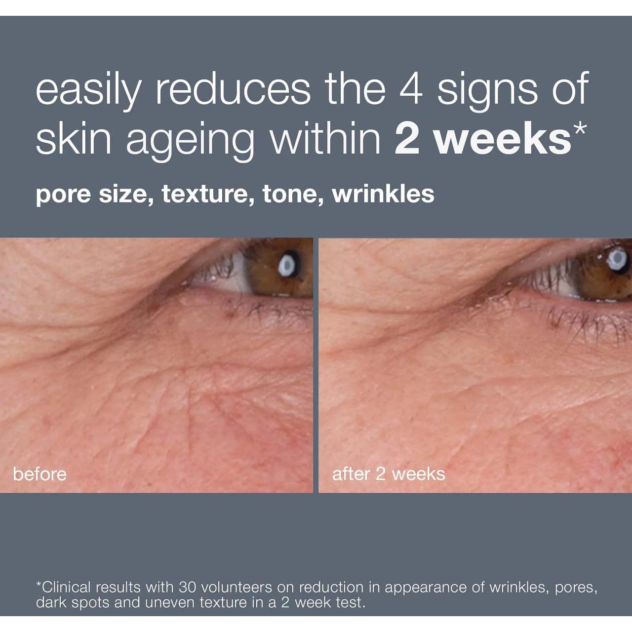 Dermalogica Dynamic Skin Retinol Serum 30 ml (obrázok 8)