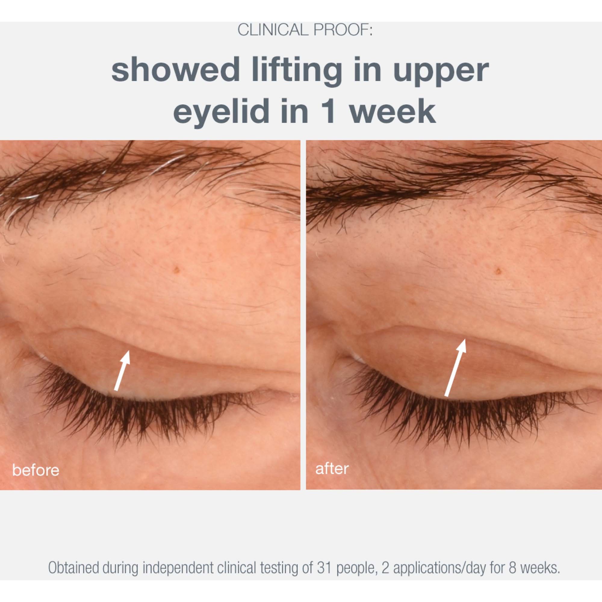 Dermalogica Lifting Eye Cream 15 ml (obrázok 6)