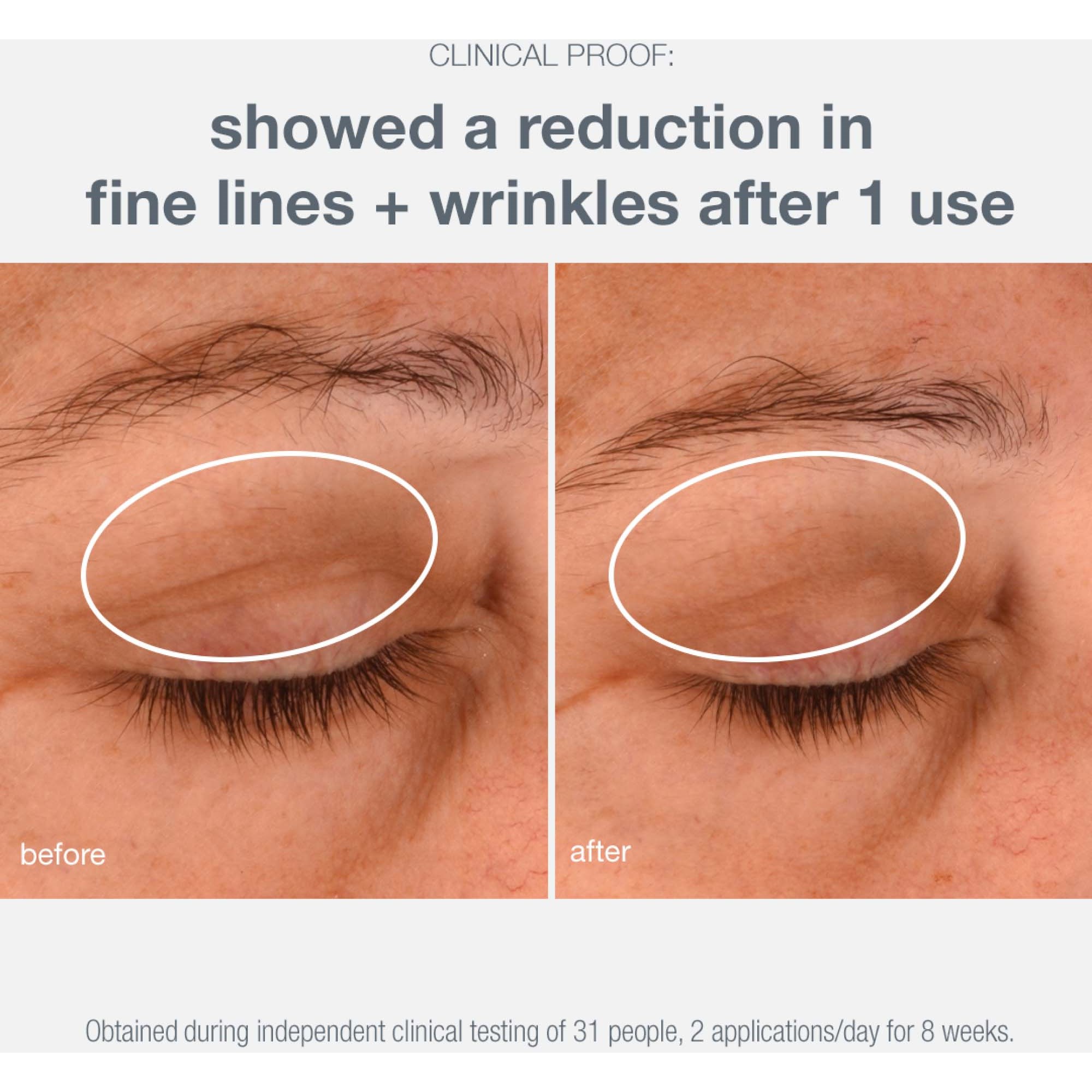 Dermalogica Lifting Eye Cream 15 ml (obrázok 7)