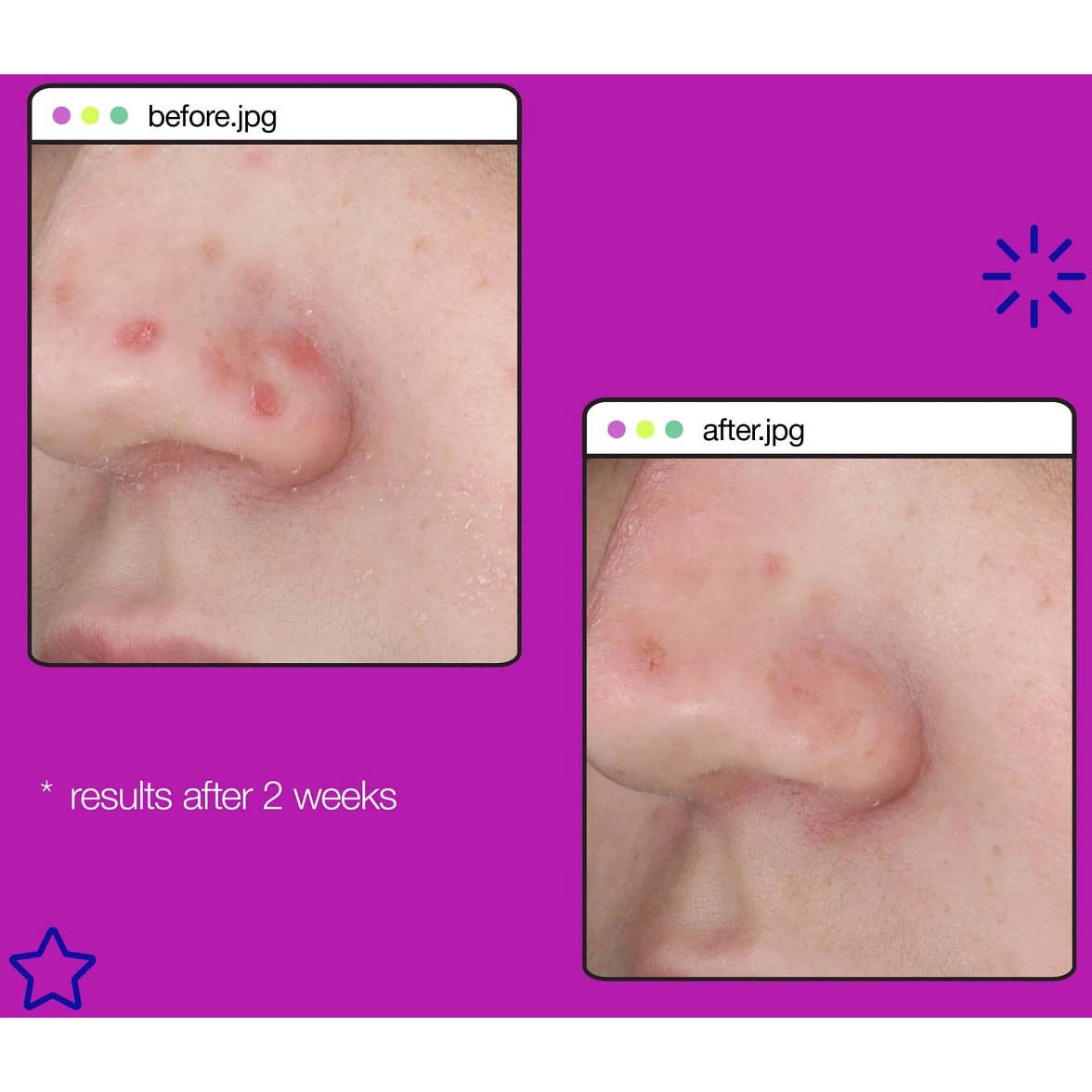 Dermalogica Clear Start Post-Breakout Fix 15 ml (obrázok 8)