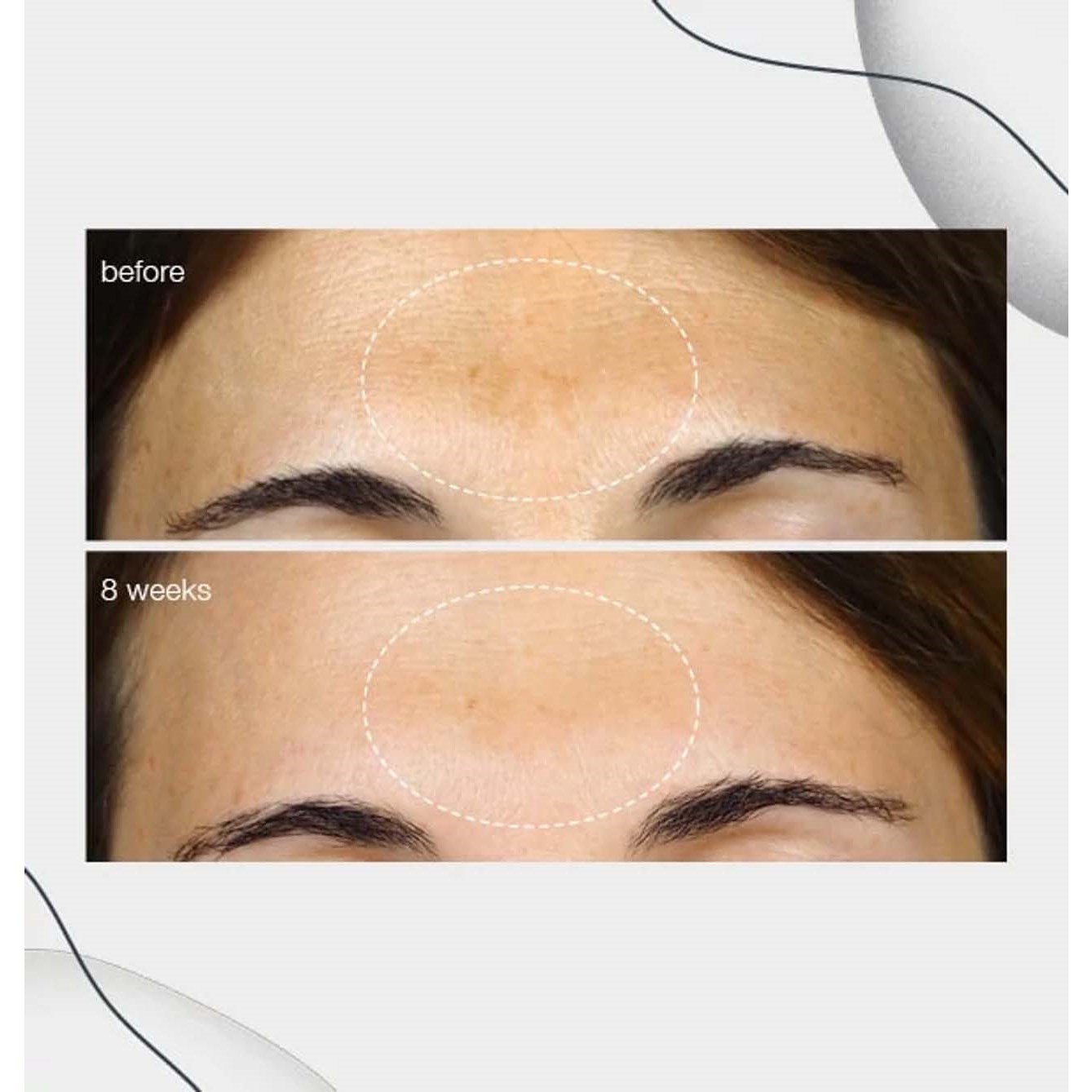 Dermalogica Powerbright Dark Spot Serum likwidujące przebarwienia (obrázok 5)