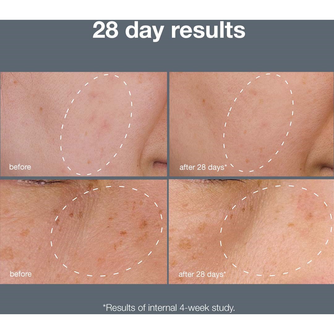 Dermalogica Powerbright Dark Spot System (obrázok 4)