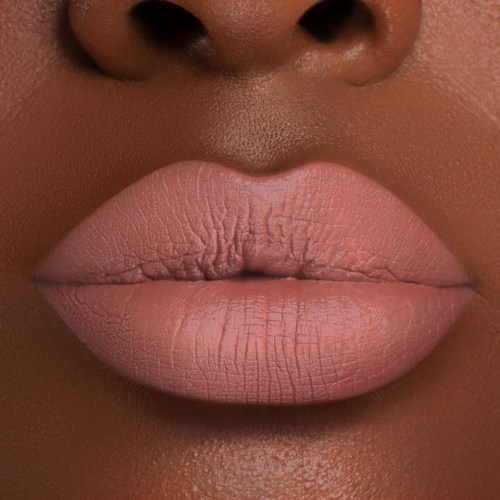 Close-up van volle, roze, droge lippen met zichtbare barstjes en textuur.