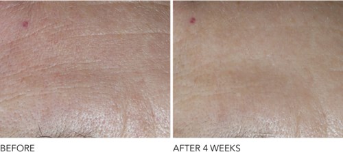 Dr Dennis Gross Advanced Retinol + Ferulic Overnight Texture Renewal Peel 16 ml