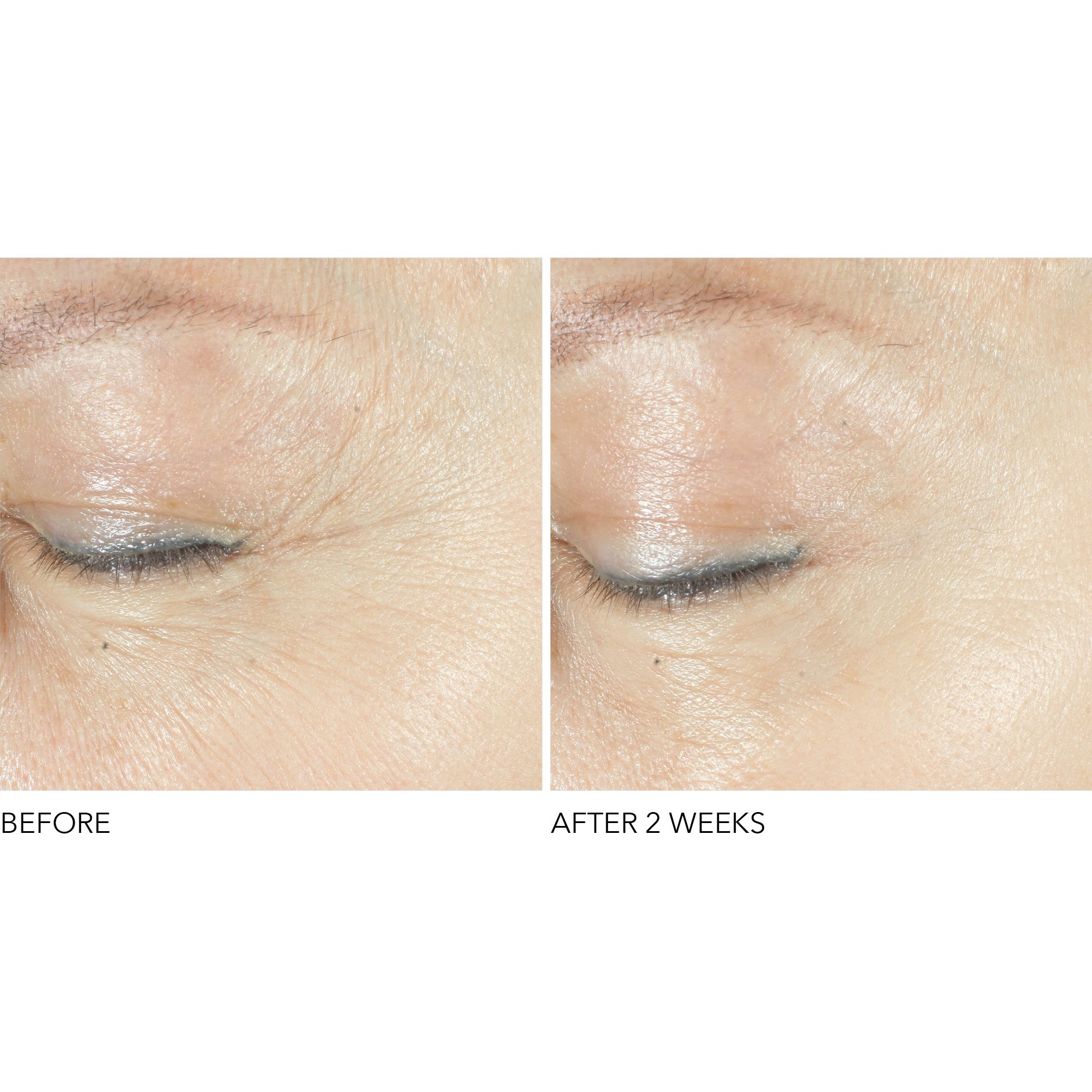 Alternativ bild 1 för Dr Dennis Gross Advanced Retinol + Ferulic Triple Correction Eye Serum