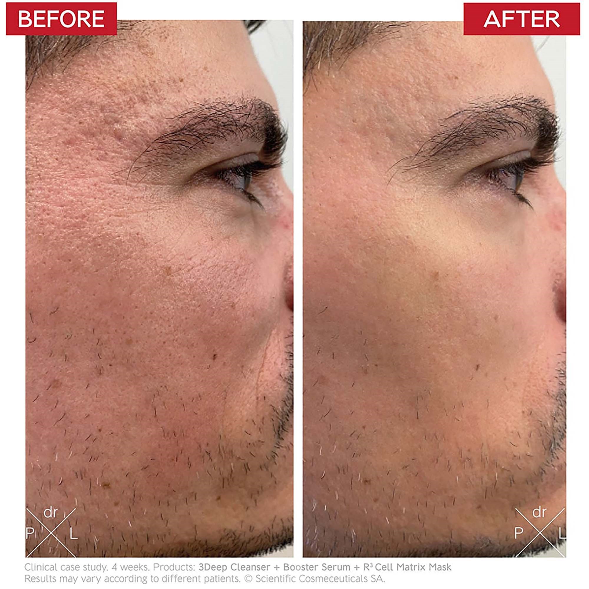 Dr. Levy Booster Serum 30 ml (zdjęcie 3)