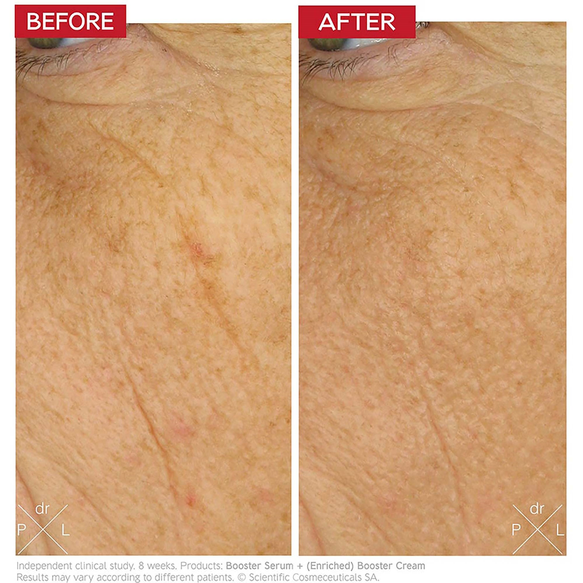 Dr. Levy Enriched Booster Cream (zdjęcie 3)