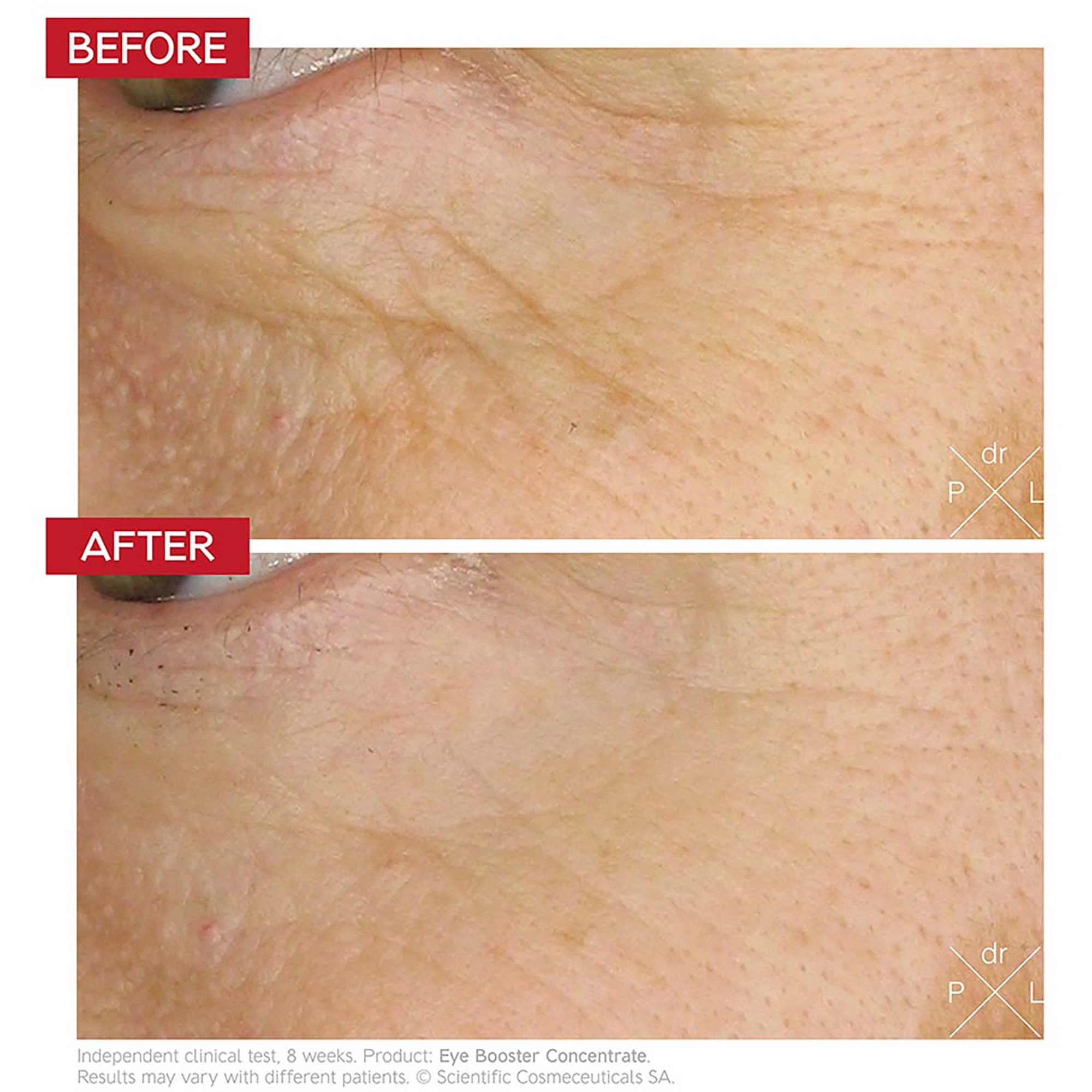 Dr. Levy Eye Booster Concentrate 15 ml (zdjęcie 3)
