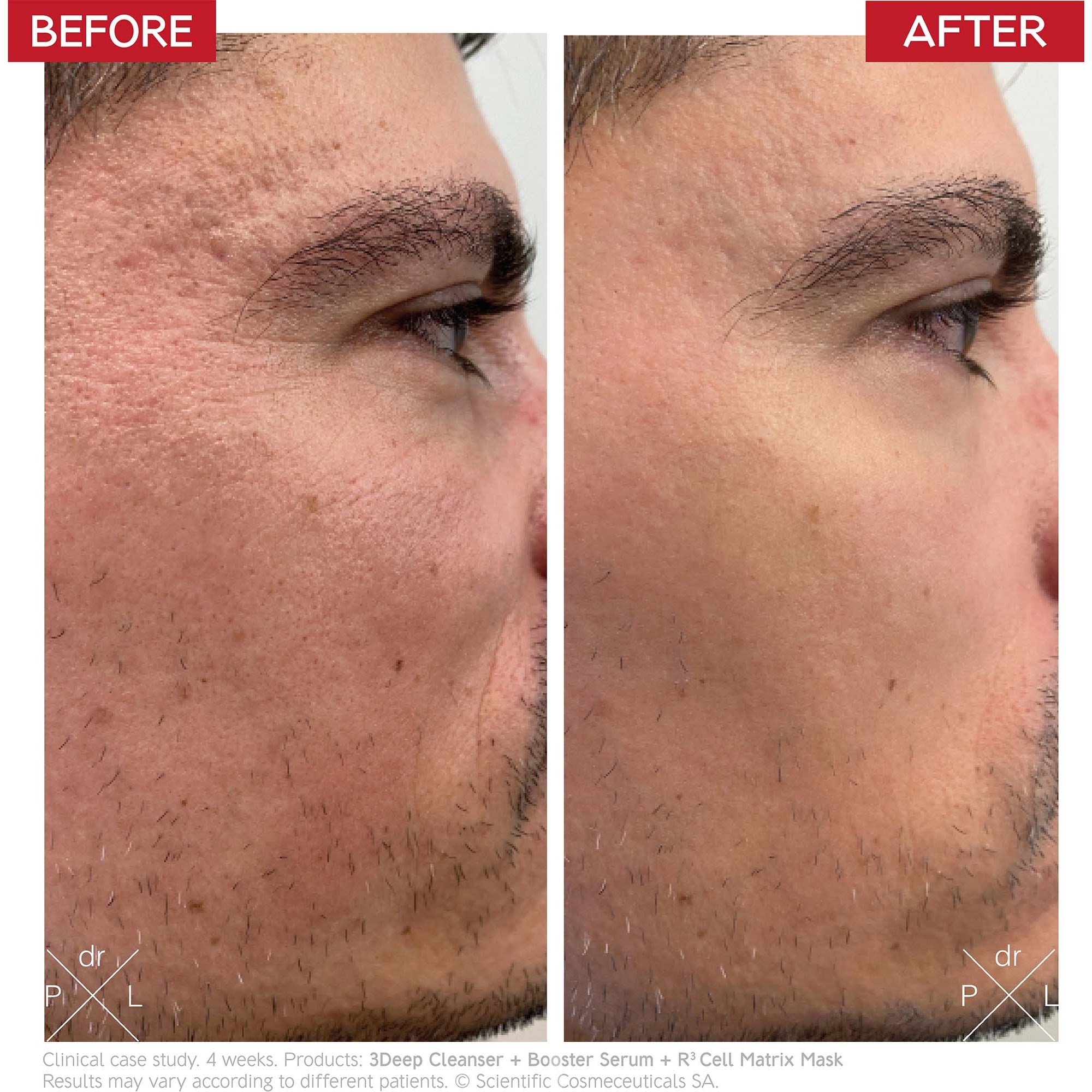 Dr. Levy MicroSkin Roller 72 g (zdjęcie 3)