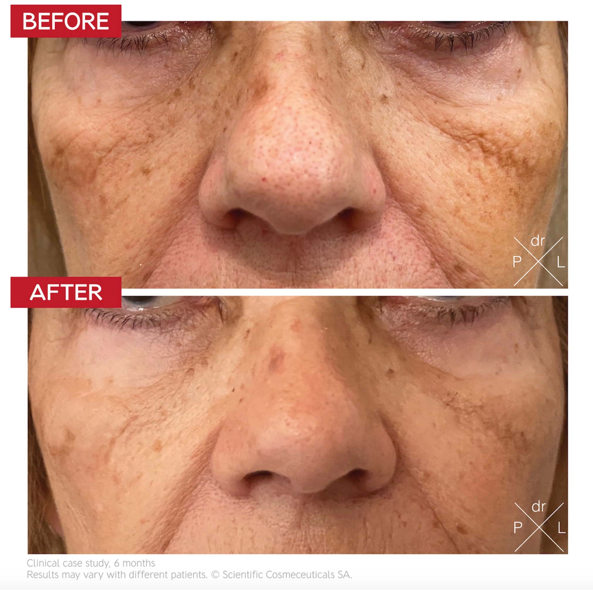Dr. Levy Pigment Control Drops 30 ml (zdjęcie 4)