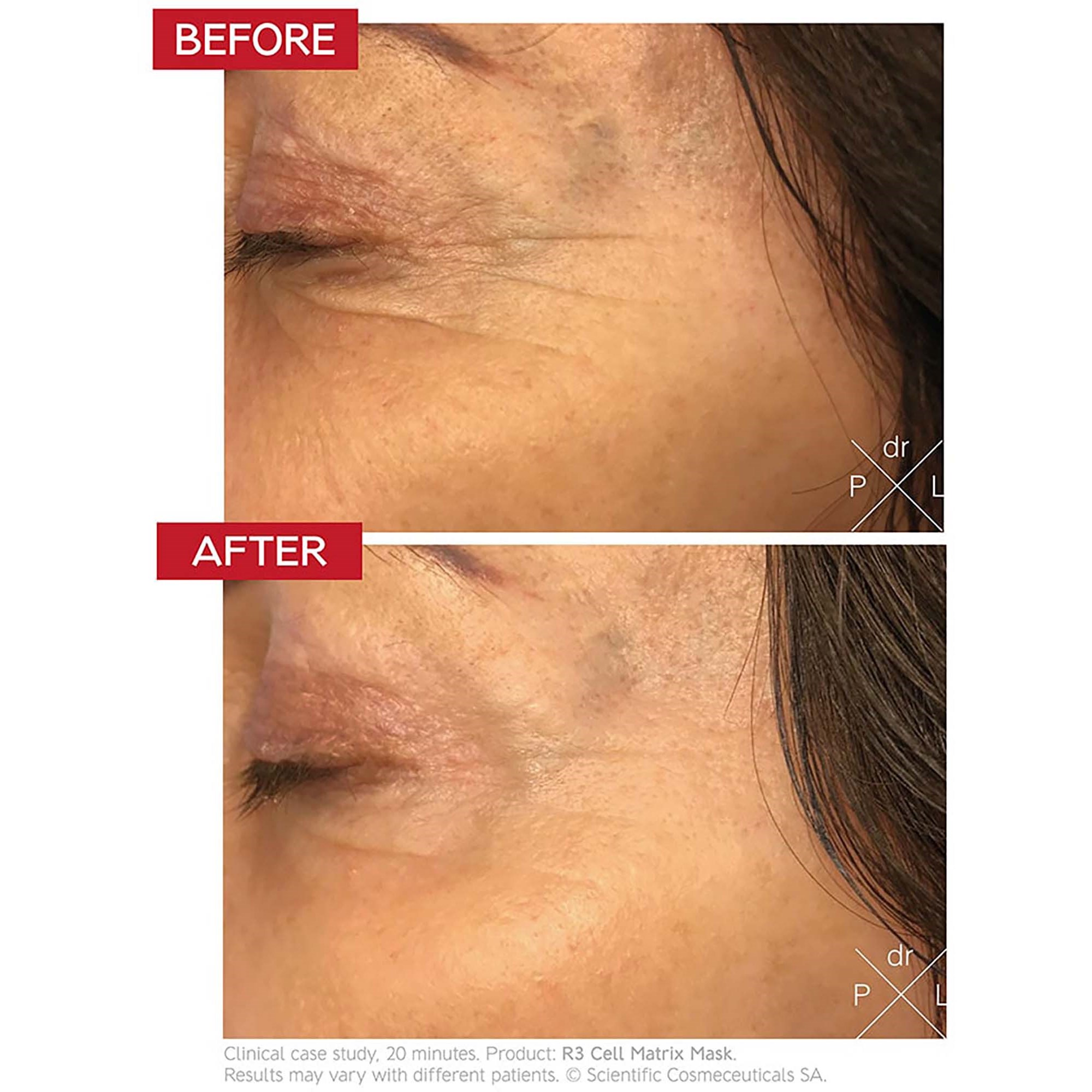 Dr. Levy R3 Cell Matrix Mask 50 ml (zdjęcie 3)