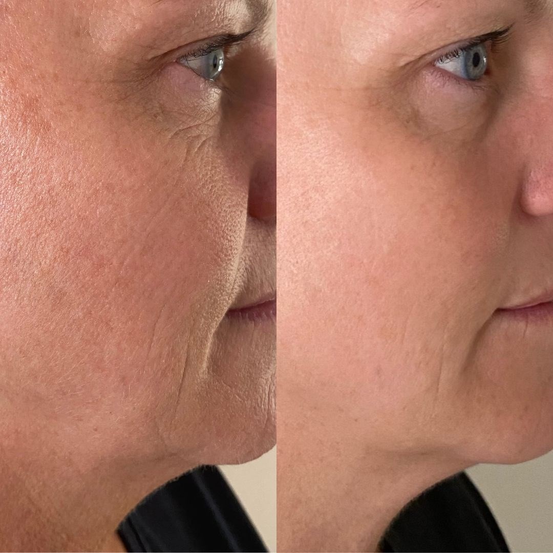 Eco By Sonya Serum of Plenty 30 ml (obrázok 3)