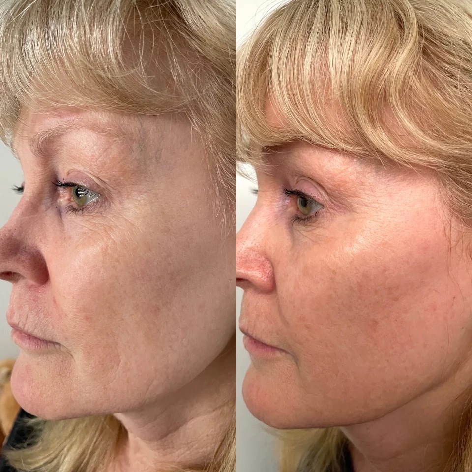 Eco By Sonya Serum of Plenty 30 ml (obrázok 6)