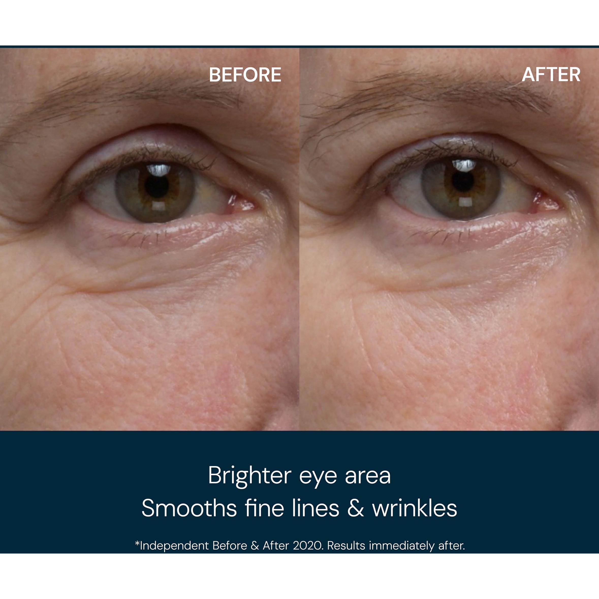 Elemis Pro-Collagen Eye Revive Mask (obrázok 8)