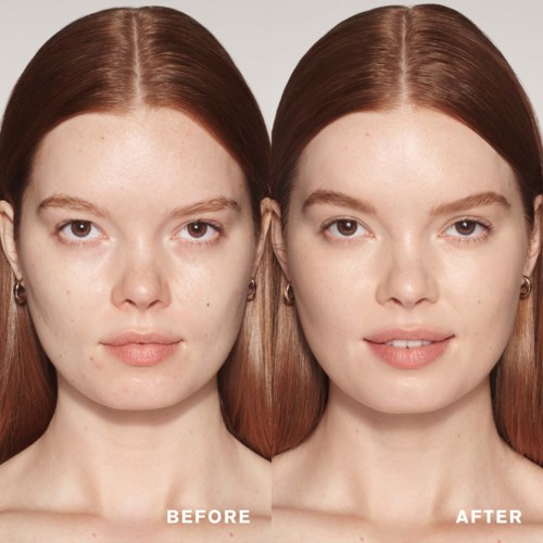 A woman with clear skin, showing a before and after comparison of skin improvement.