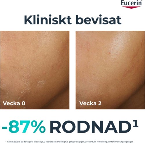 Dwa zdjęcia skóry pokazują poprawę od tygodnia 0 do 2 po użyciu Eucerin. Skóra wygląda na jaśniejszą i gładszą.