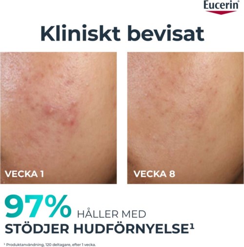 Før og etter-bilder viser forbedring av huden, uten rødhet og merker, over åtte uker.