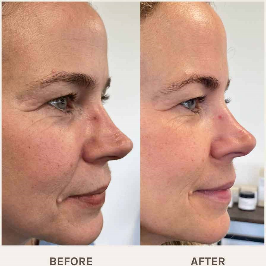Evolve Organic Beauty Age Defying Lifting Serum 30 ml (obrázok 5)